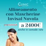 Allineamento con Mascherine Invisal Nuvola