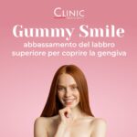 Gummy Smile