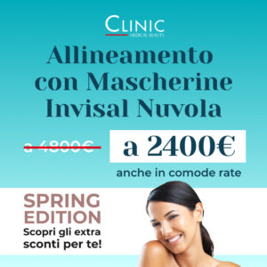 Allineamento con Mascherine Invisal Nuvola